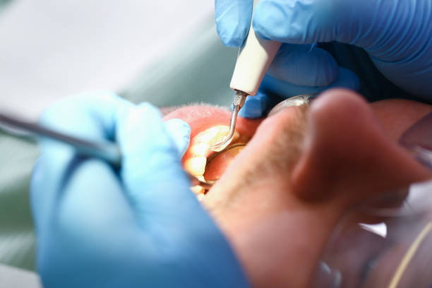 Best Knocked-Out Tooth Emergency  in Granby, CO
