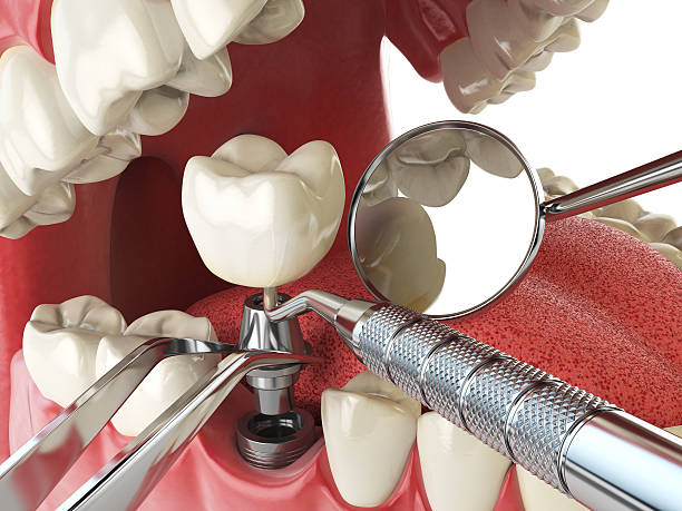 Best Dentist for Dental Trauma  in Granby, CO